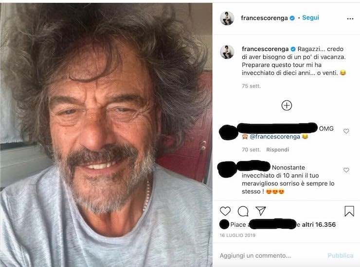 francesco renga si mostra invecchiato