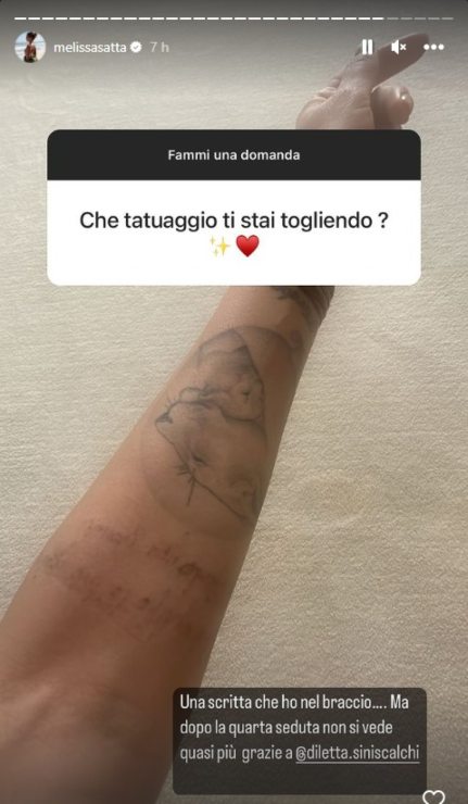 melissa satta cancella tatuaggio 