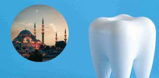 Denti Turchia