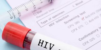 screenig gratuito test hiv