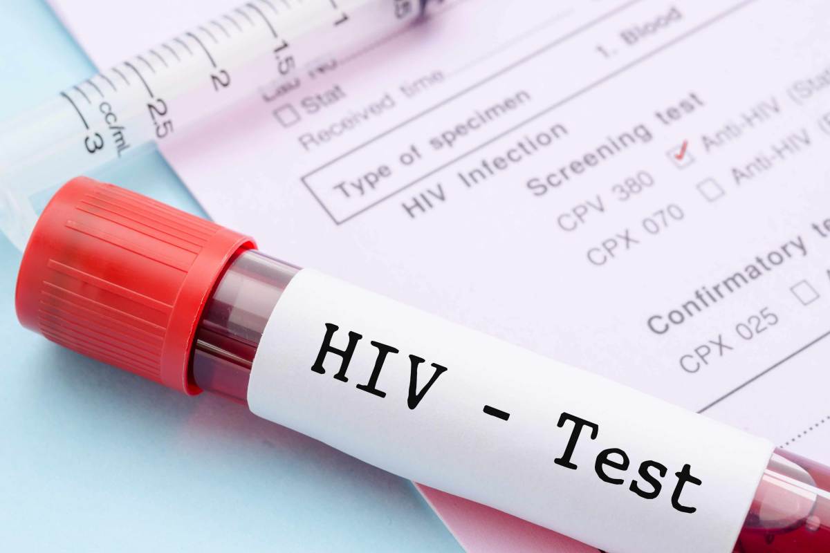 screenig gratuito test hiv