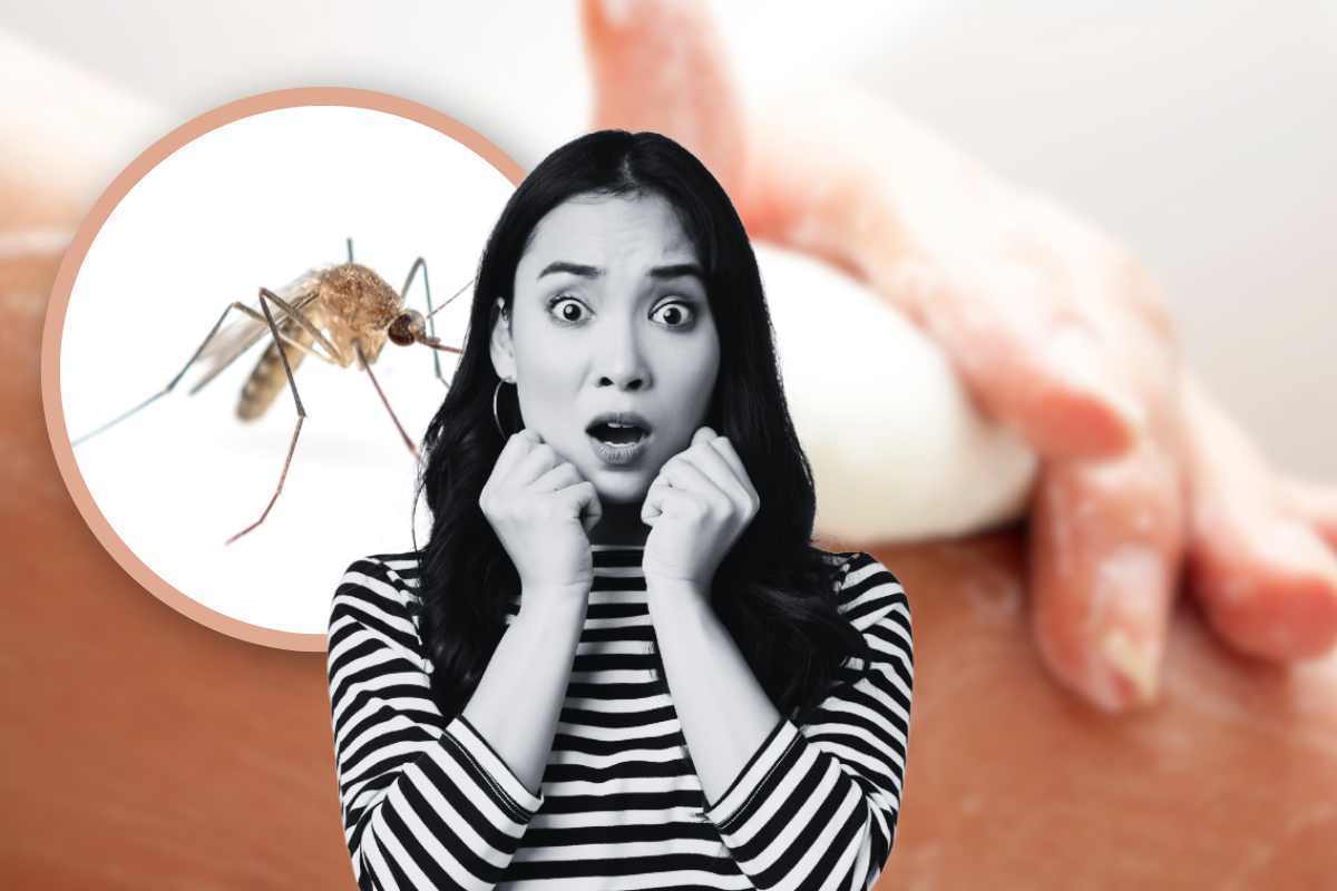 sapone: zanzare pungono alcuni più di altri