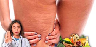 Cibi alleati nella lotta alla cellulite