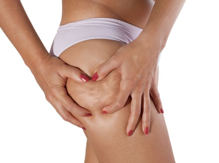 eliminare la cellulite con il sale