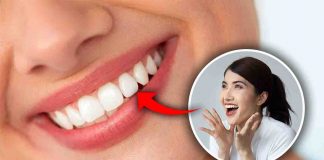 ottenere denti bianchi