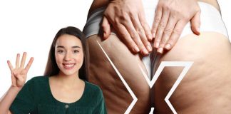 cuscinetti sulle cosce smagliature come eliminarli