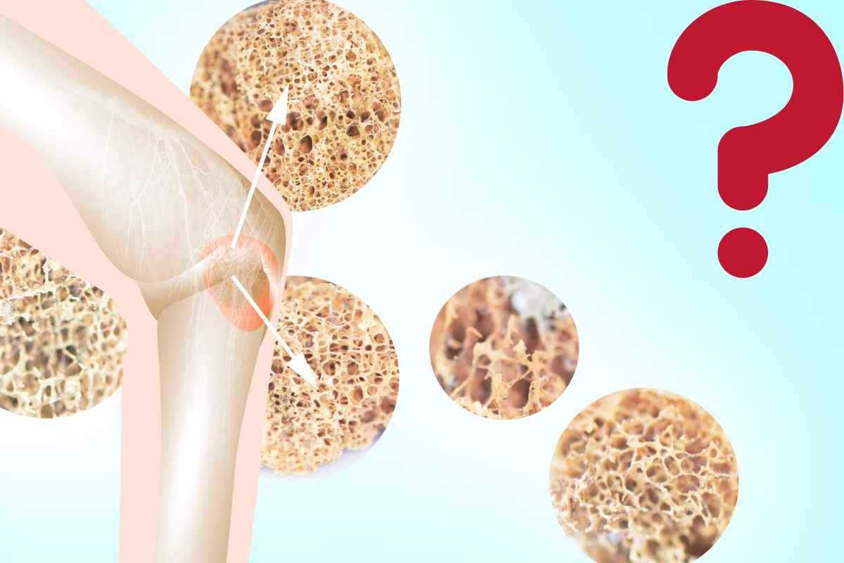 osteoporosi dieta