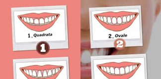 La forma dei denti test
