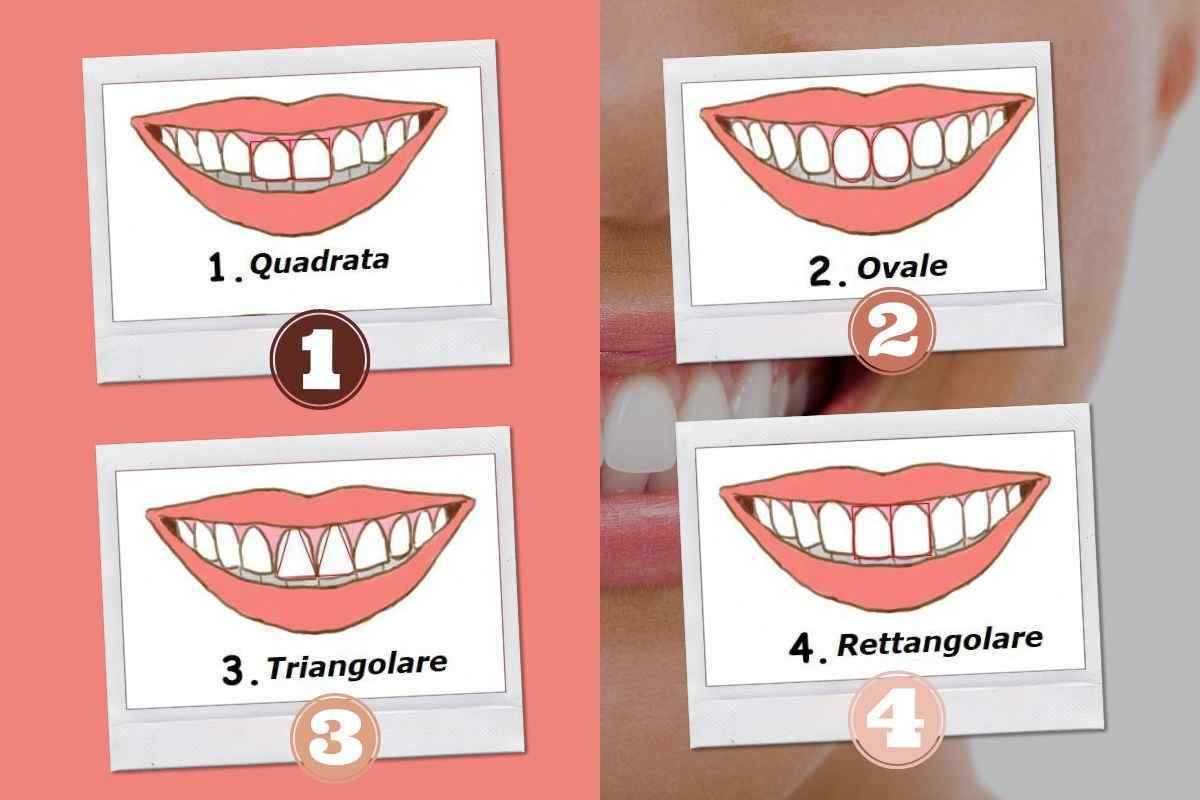 La forma dei denti