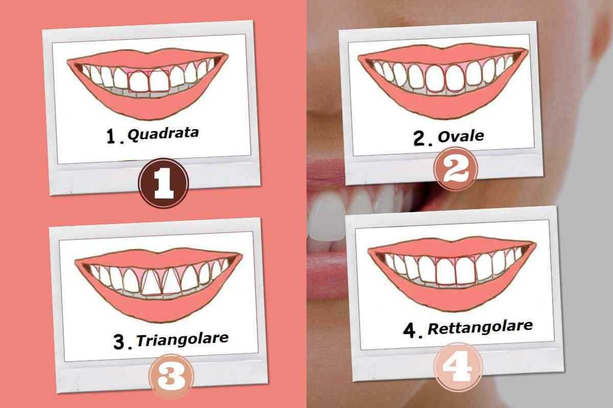 La forma dei denti test