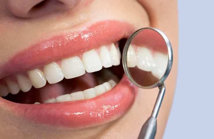 denti trasparenti dentista