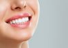 I denti trasparenti possono essere causati da diversi fattori
